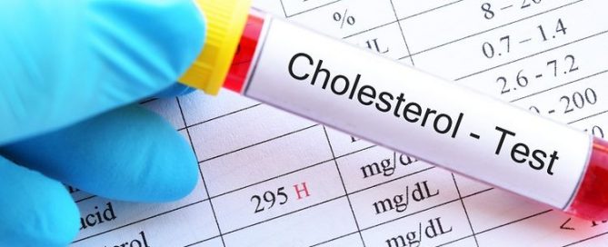 Bagi penderita kolesterol, perhatikan daftar tabel jumlah kolesterol pada makanan berikut ini